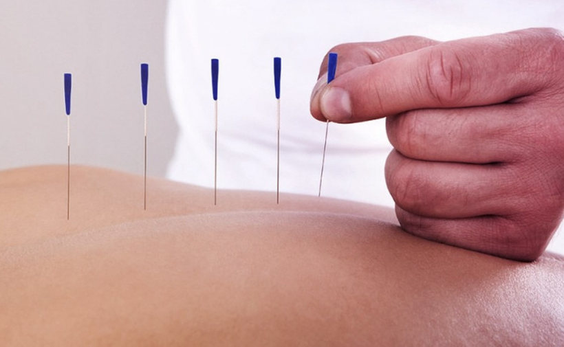Ebracursos oferece especialização em Dry Needling e Auriculoterapia