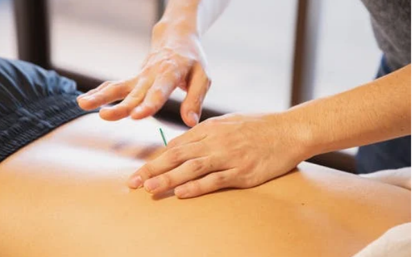 Vagas abertas para o curso de Dry Needling em dezembro